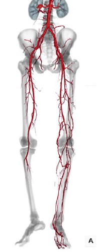 CT angiogram