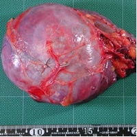 specimen,spleen