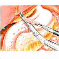 delta_anastomosis