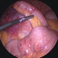 appendix